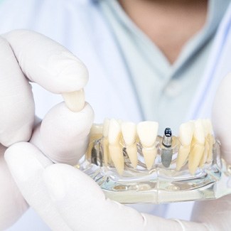 Gloved hand holding sample jaw with implant and a dental crown