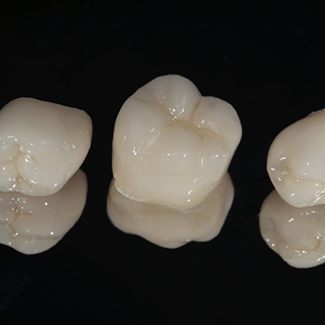 Three dental crowns against black background