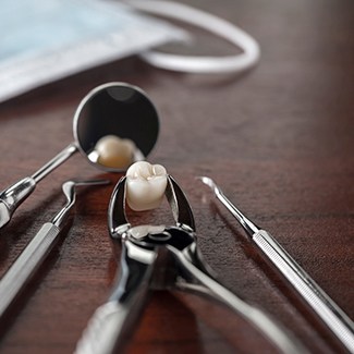 dental forceps holding a tooth