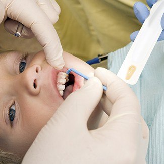 Child receiving fluoride treatment in East Dallas