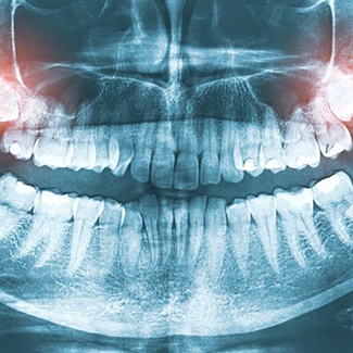 Person suffering from mouth pain