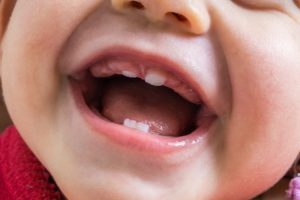 Close-up of baby teeth coming in.